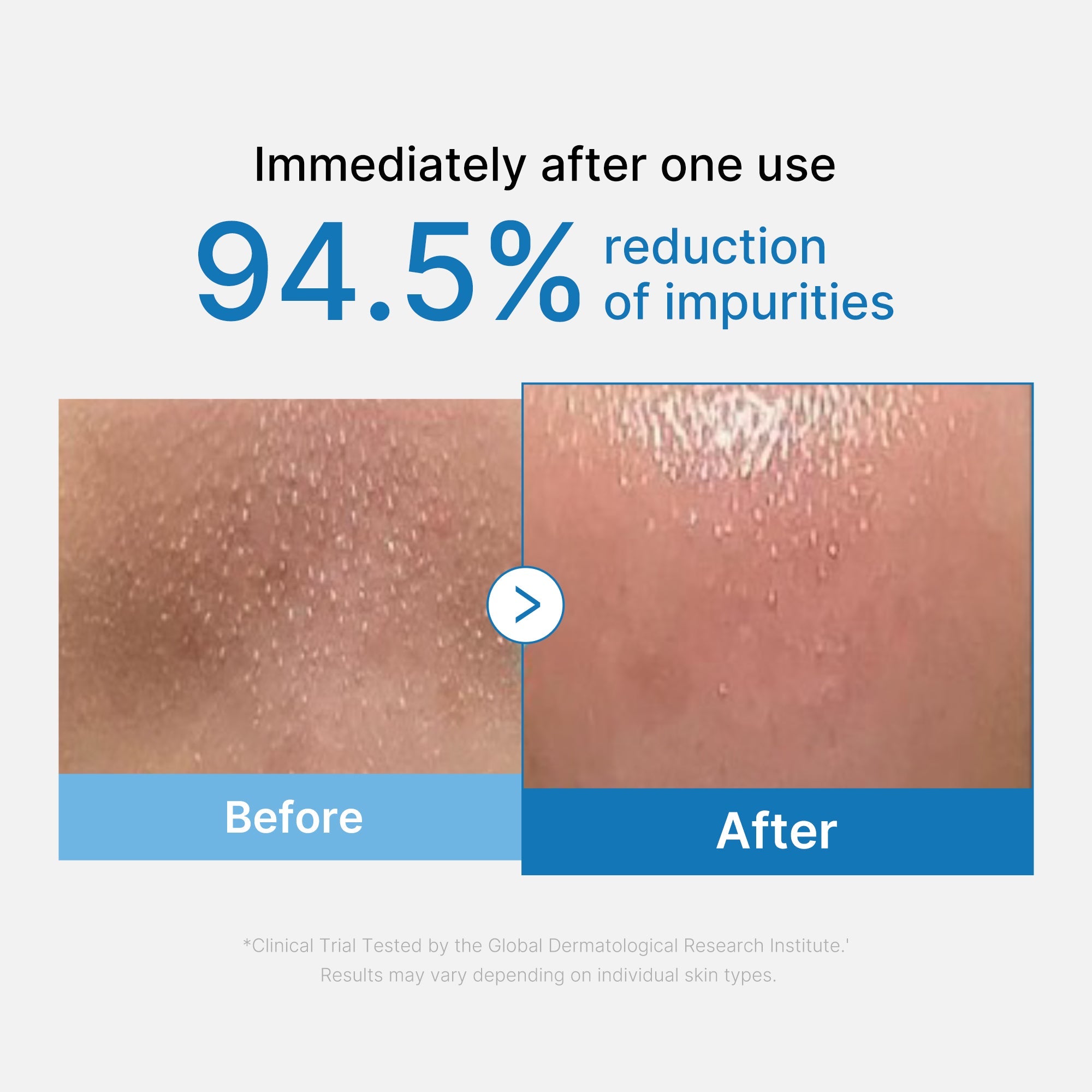 Zero Pore Blackhead Deep Cleansing Oil T4