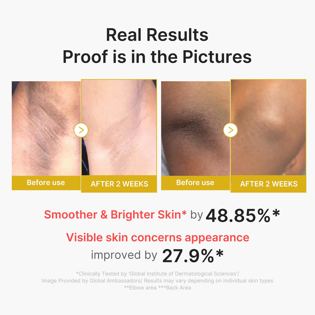 Kojic Acid Turmeric Body Peel Shot G3