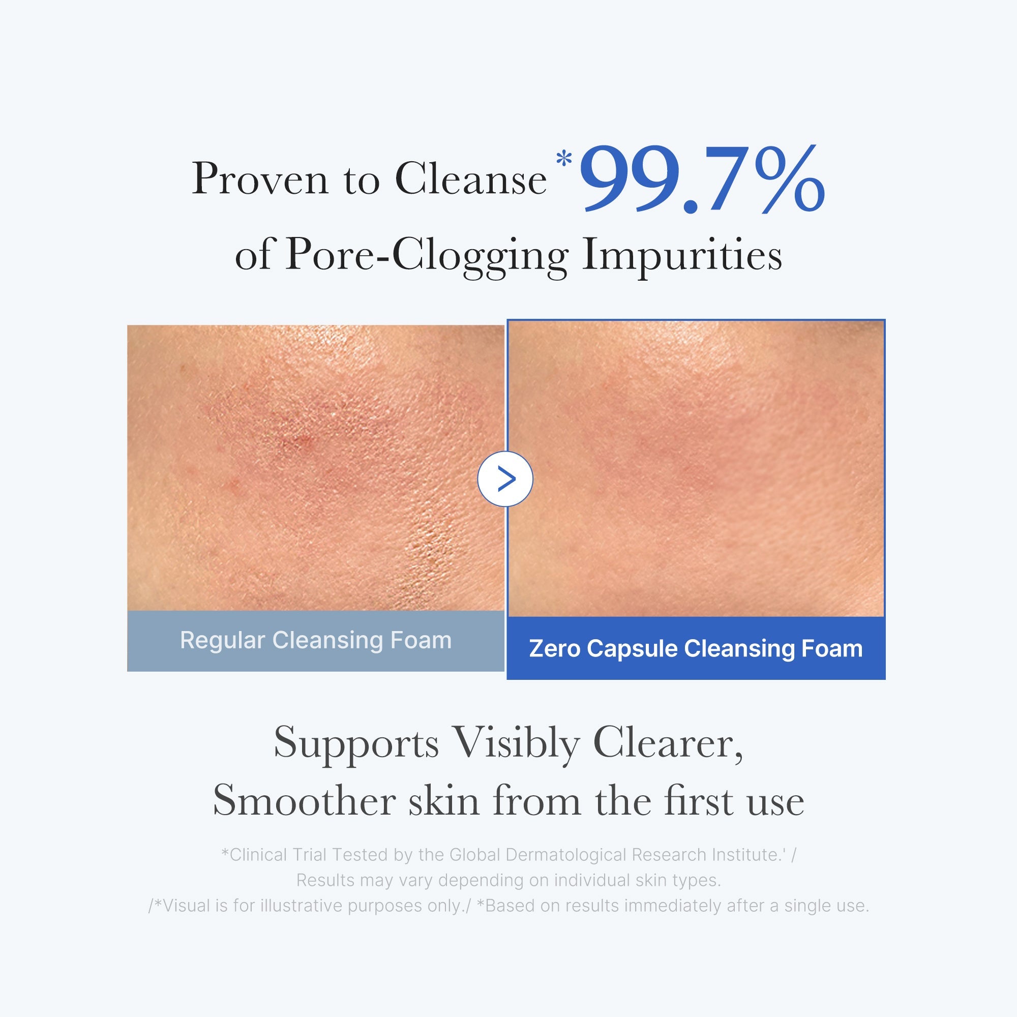 Zero Pore Capsule Cleansing Foam Z8