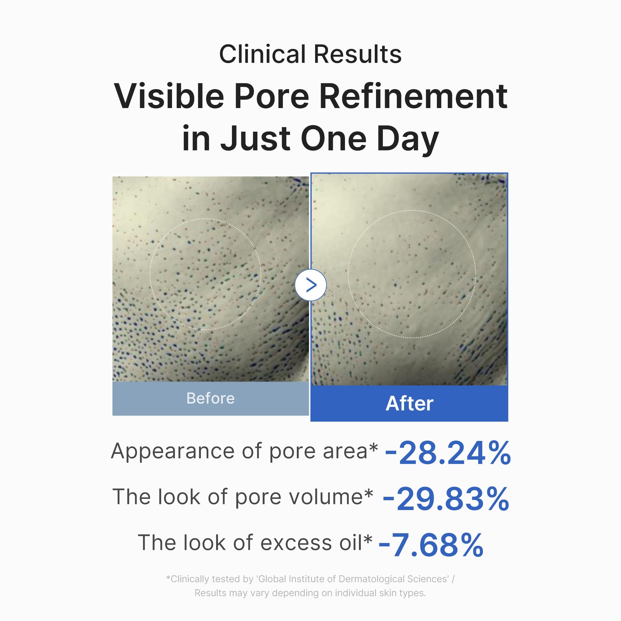 Zero Pore One-day Peptide Serum W8