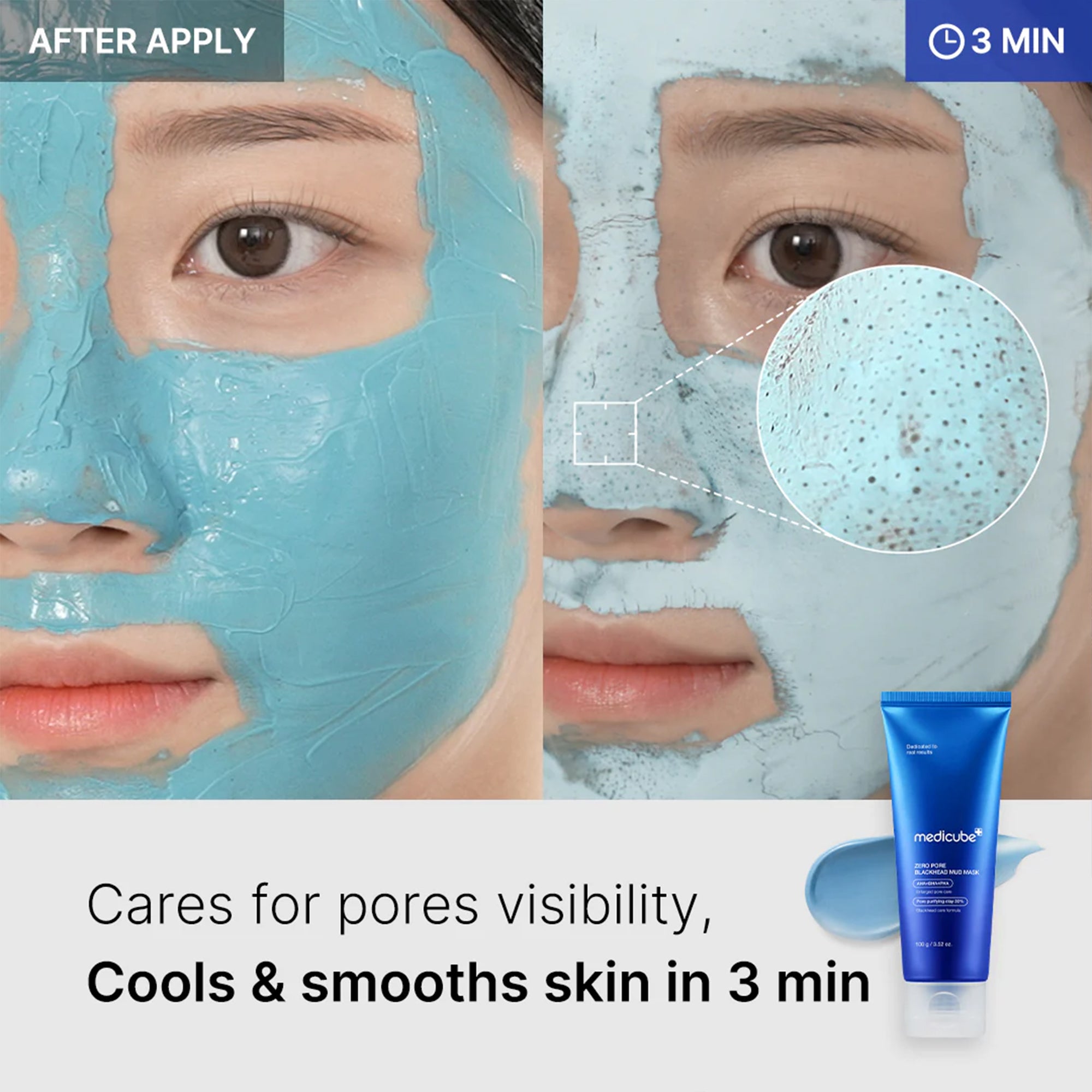 Zero Pore Blackhead Mud Mask H9