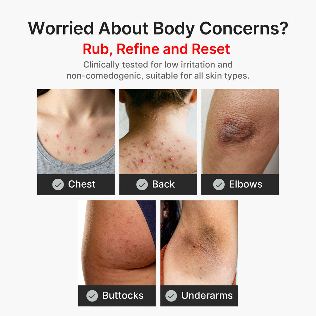 Kojic Acid Turmeric Body Peel Shot G3