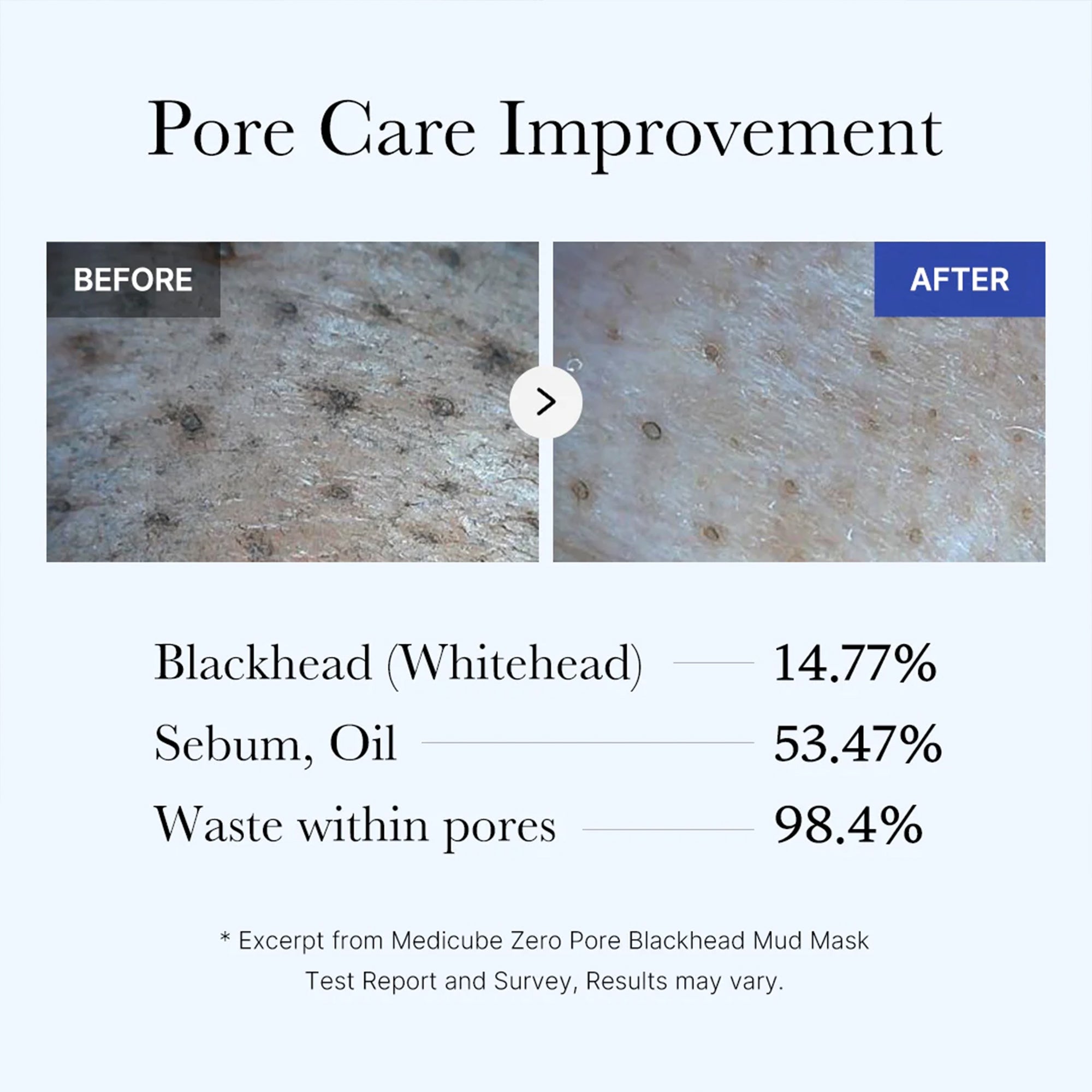 Zero Pore Blackhead Mud Mask H9