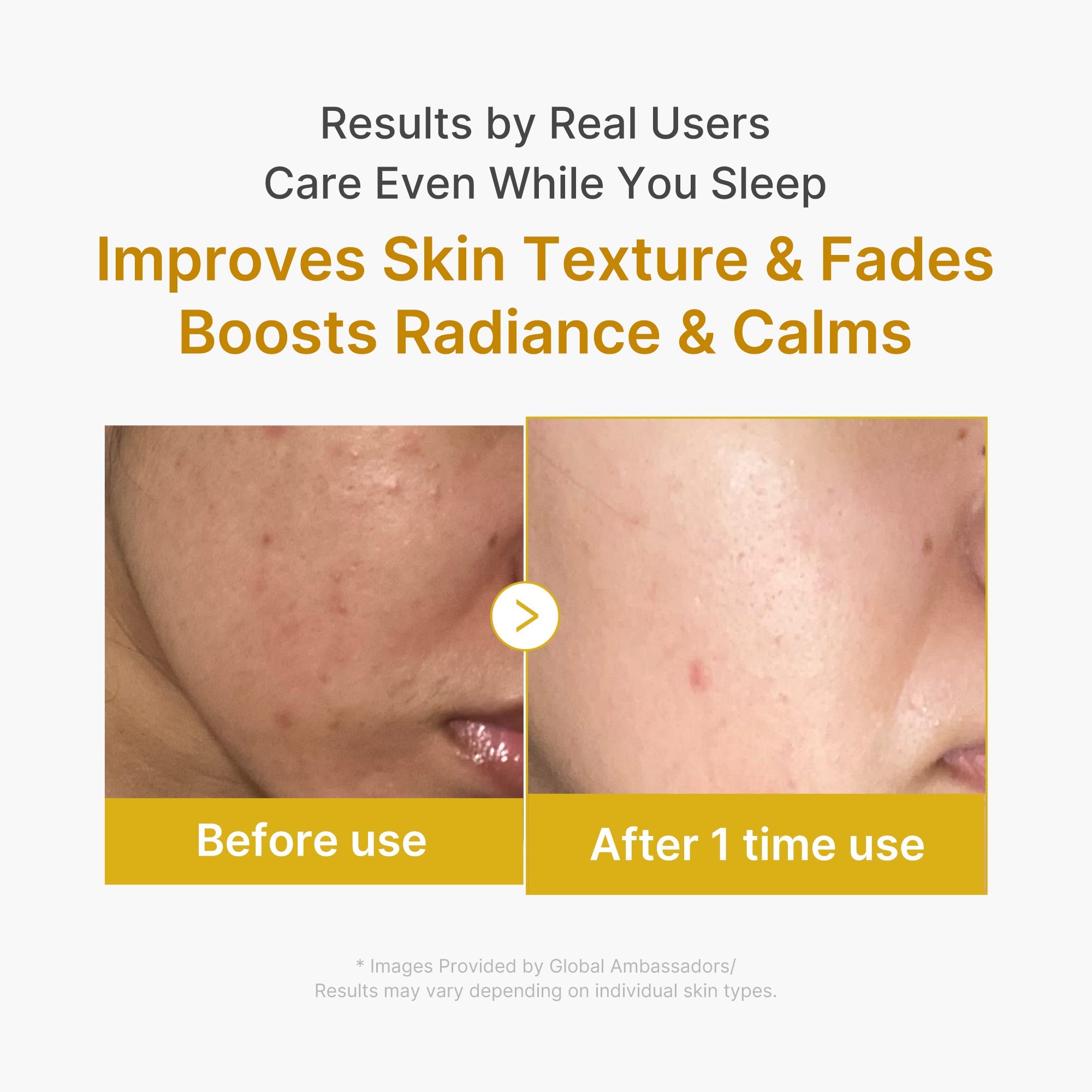 Kojic Acid Turmeric Overnight Wrapping Mask E1