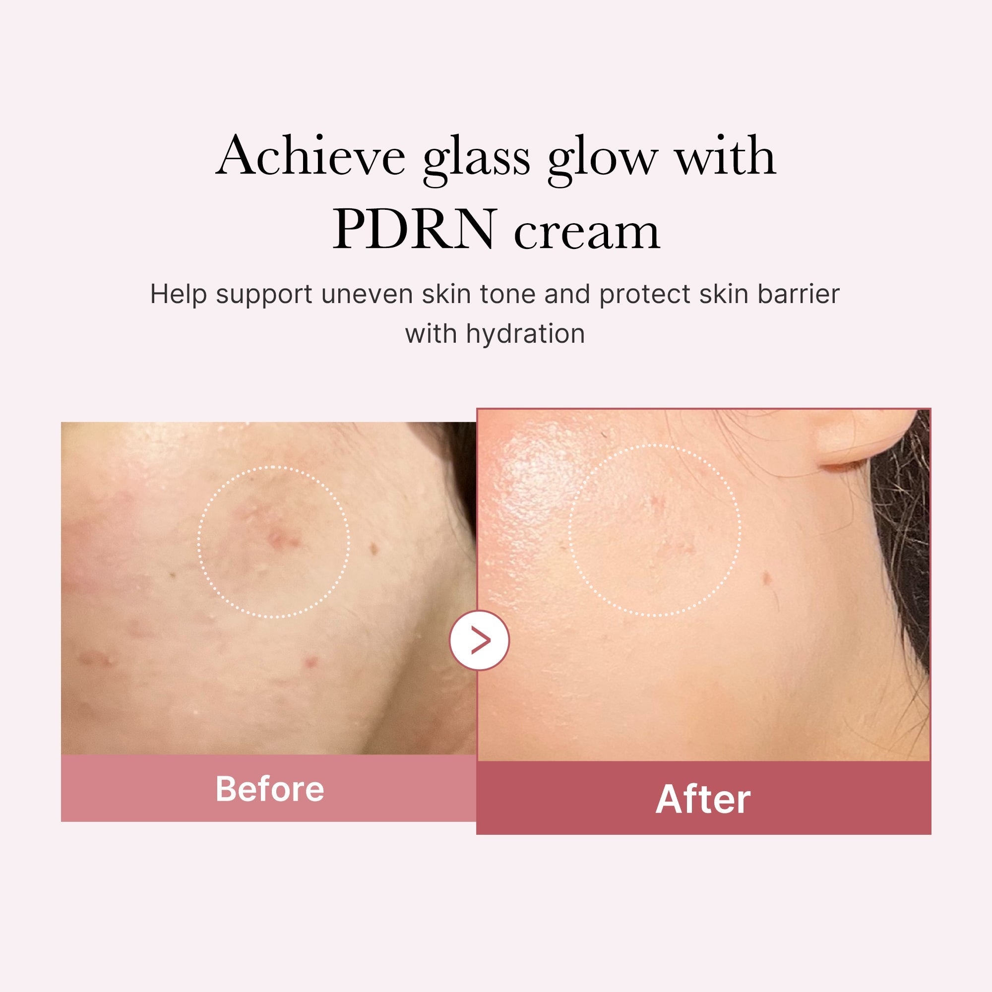 PDRN Pink Peptide Cream C7