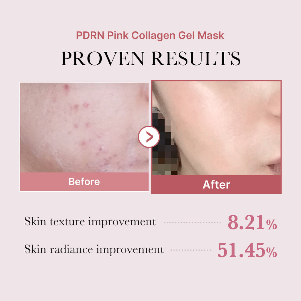 Salmon PDRN Pink Collagen Jelly Gel Mask N2