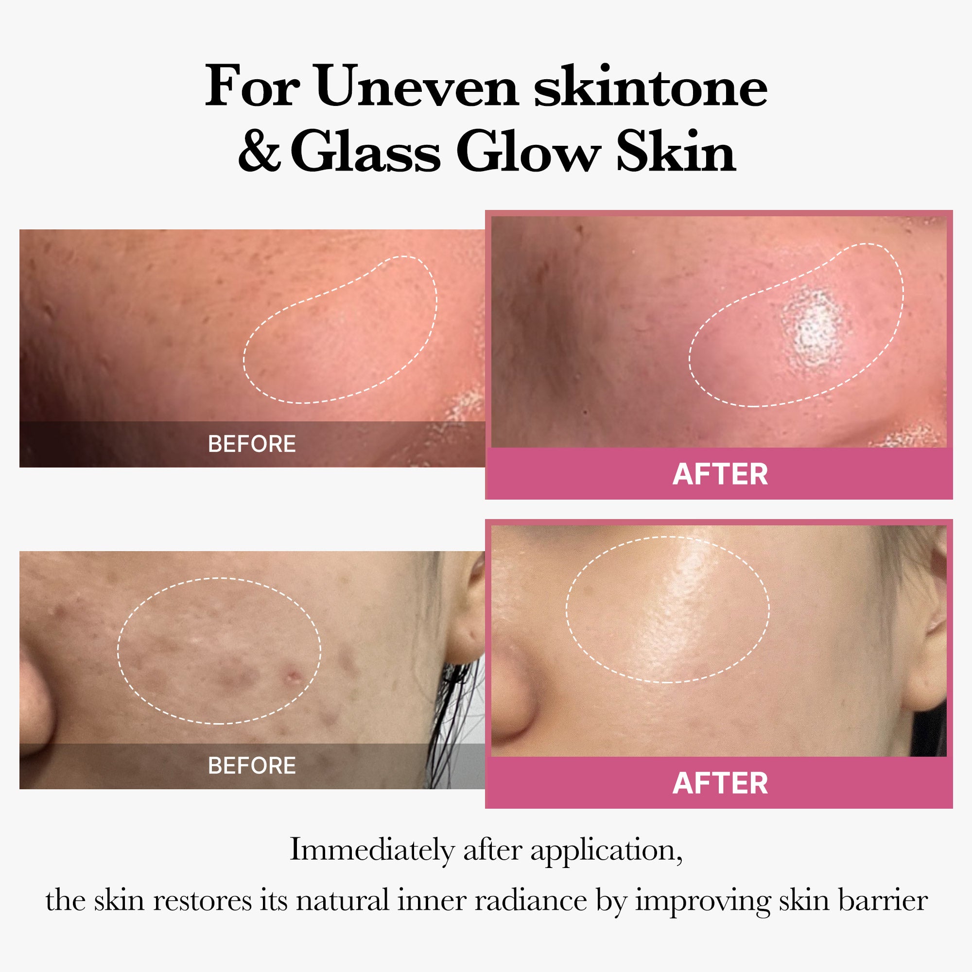 [Tati's Exclusive] All About Glow Set I6